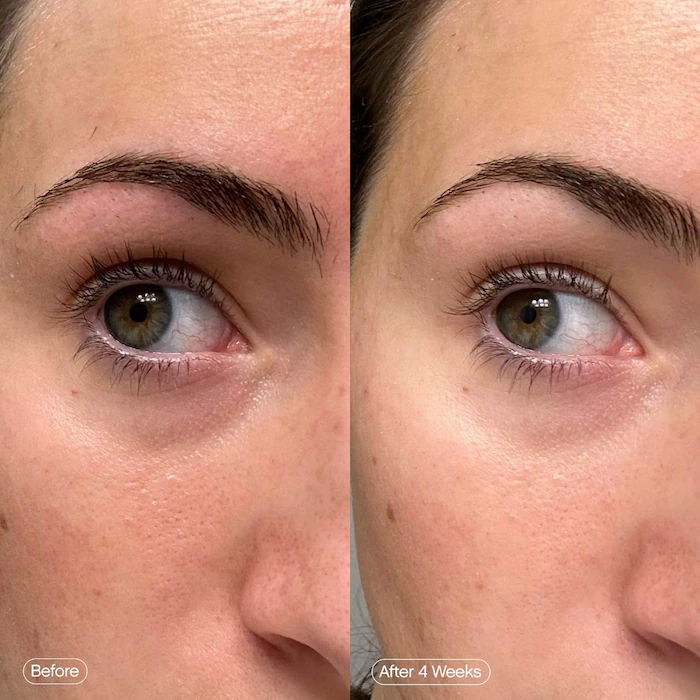 Topicals Brightening Hydrogel Eye Patches | Helps Fade Dark Circles & Dullness, Soothe + Hydrate, Brighten the Eye Area detail image 4