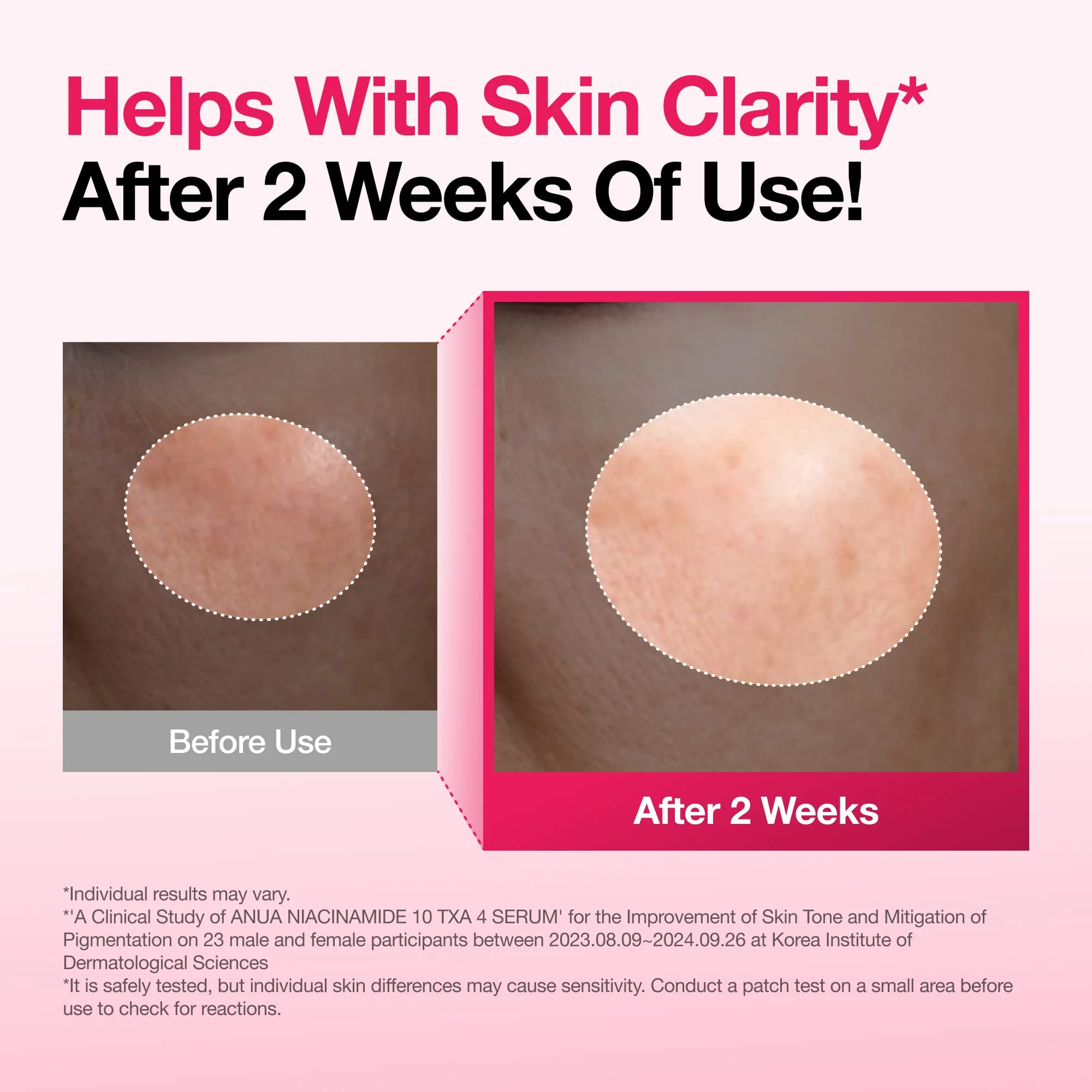 ANUA Niacinamide 10% + TXA 4% Serum 30ml — Brightening, Fades Acne Marks, Refines Pores detail image 2