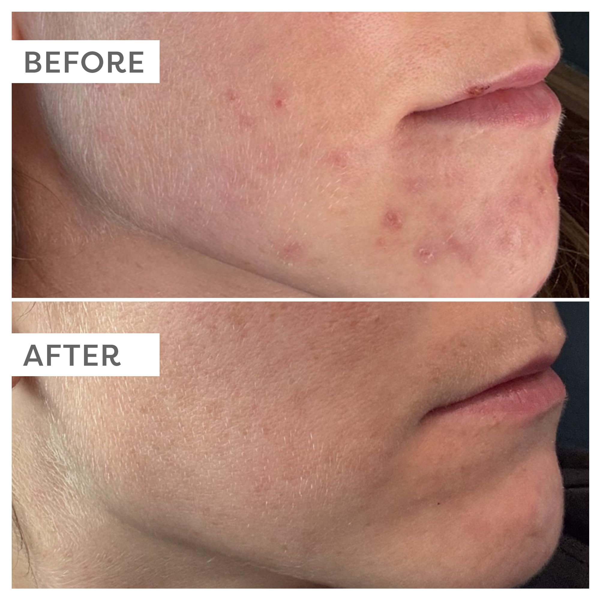TruSkin Brightening Vitamin C Serum for Face with Hyaluronic Acid, 1 fl oz detail image 4