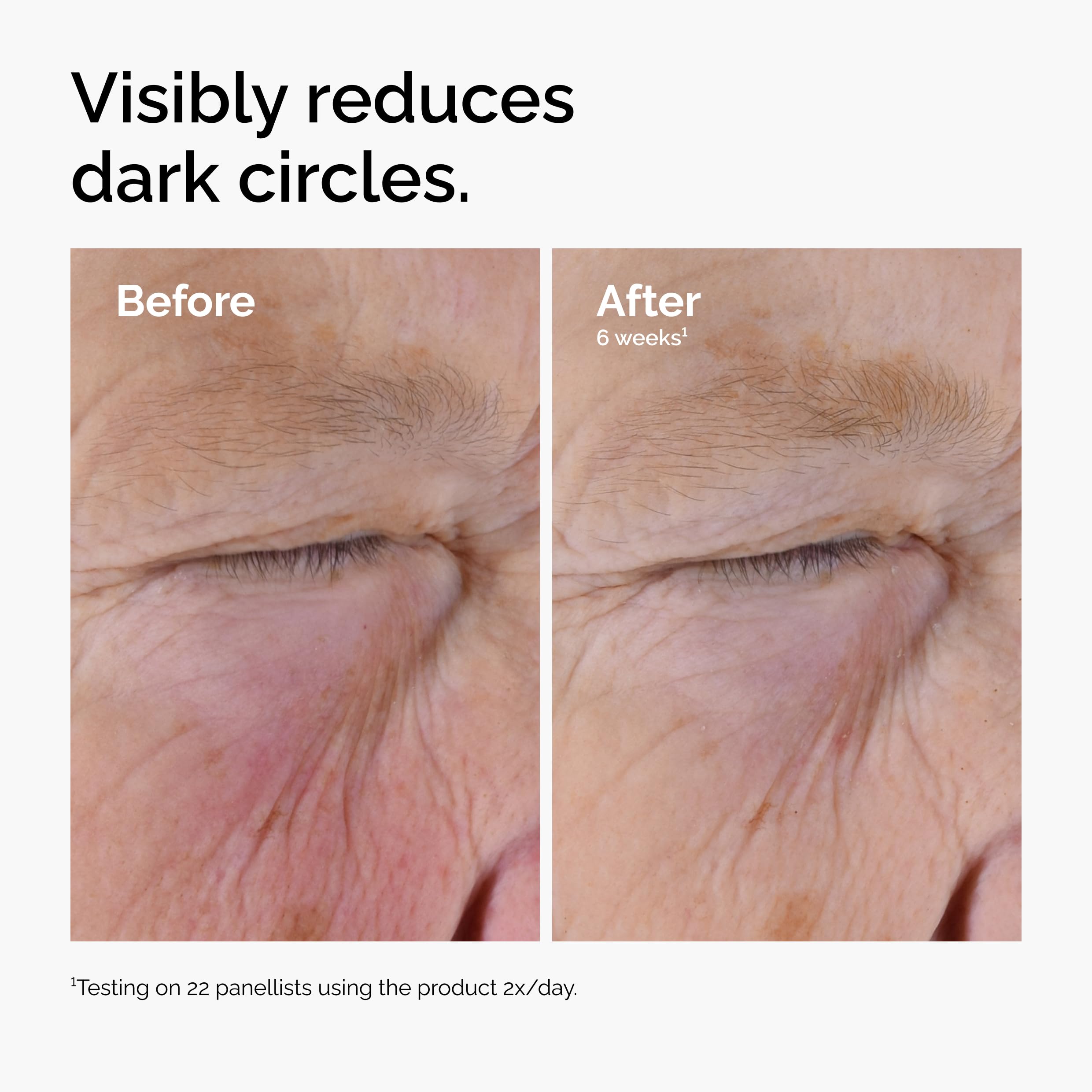 The Ordinary Caffeine Solution 5% + EGCG Eye Serum, Depuffing Eye Serum for Dark Circles and Tired Eyes detail image 5