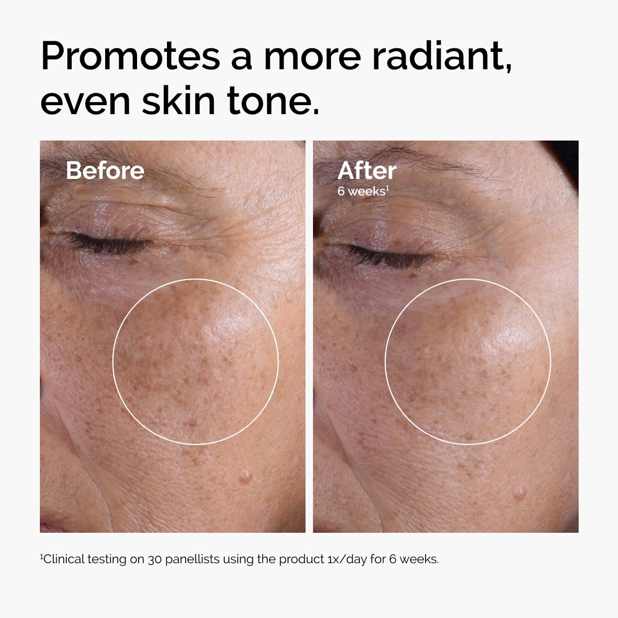 The Ordinary Glycolic Acid 7% Exfoliating Toner, Brightening and Smoothing Daily Toner for More Even-Looking Skin Tone detail image 2
