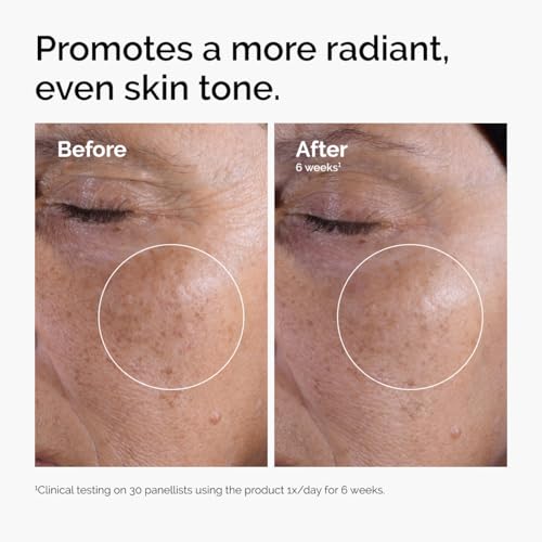 The Ordinary Glycolic Acid 7% Exfoliating Toner, Brightening and Smoothing Daily Toner for More Even-Looking Skin Tone detail image 8