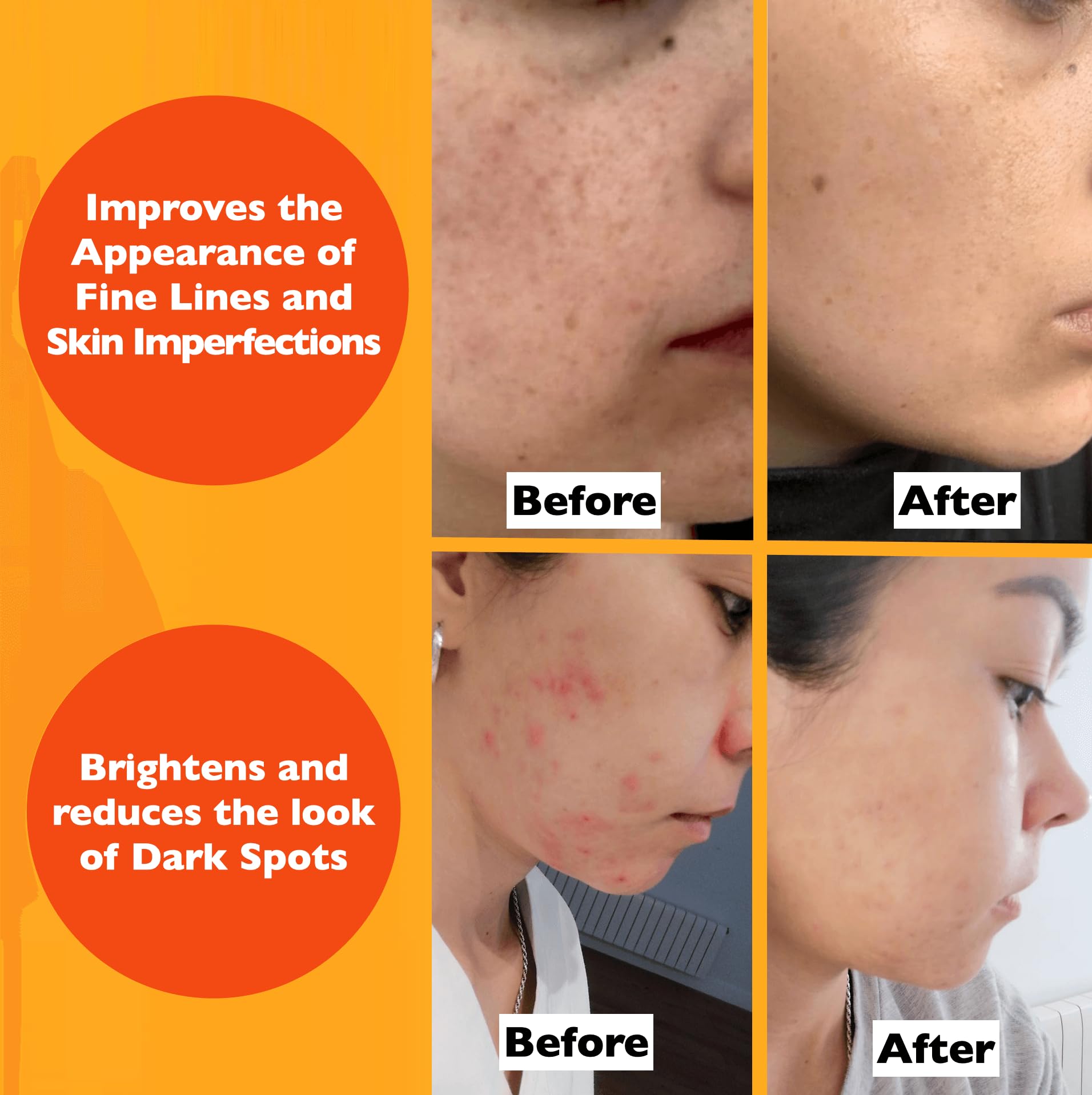 Vitamin C Serum For Face – Anti Aging Face Serum with Vitamin C, Hyaluronic Acid, Vitamin E. Brightening Formula. Improve Appearance of Dark Spots, Tone, Fine Lines & Wrinkles, Glowing Skin 2 Fl Oz detail image 5