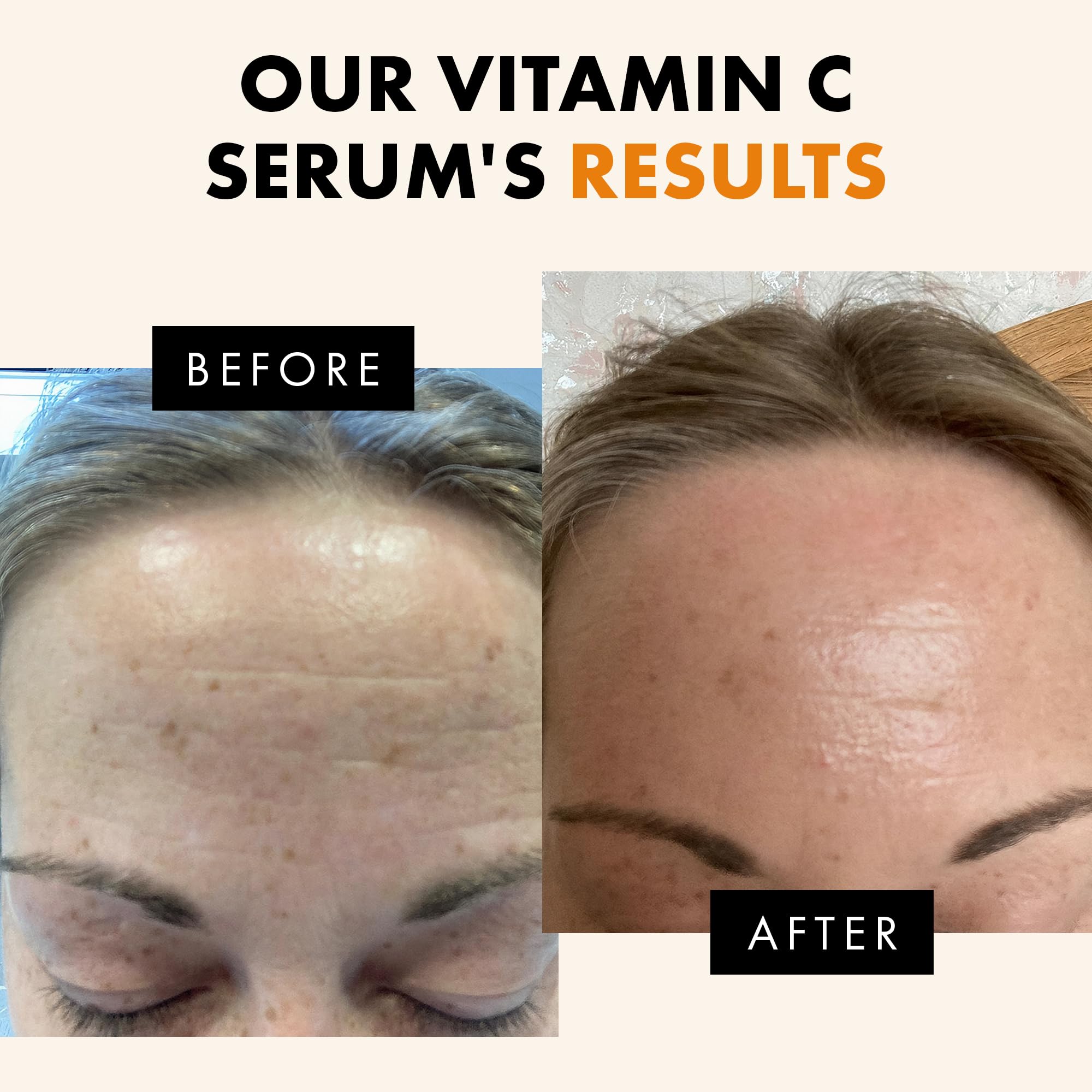 Eclat Skincare Vitamin C Serum for Dark Spots with Hyaluronic Acid, Ferulic Acid & Vitamin E – Anti-Aging Skin Brightening Serum, 1 fl oz detail image 4