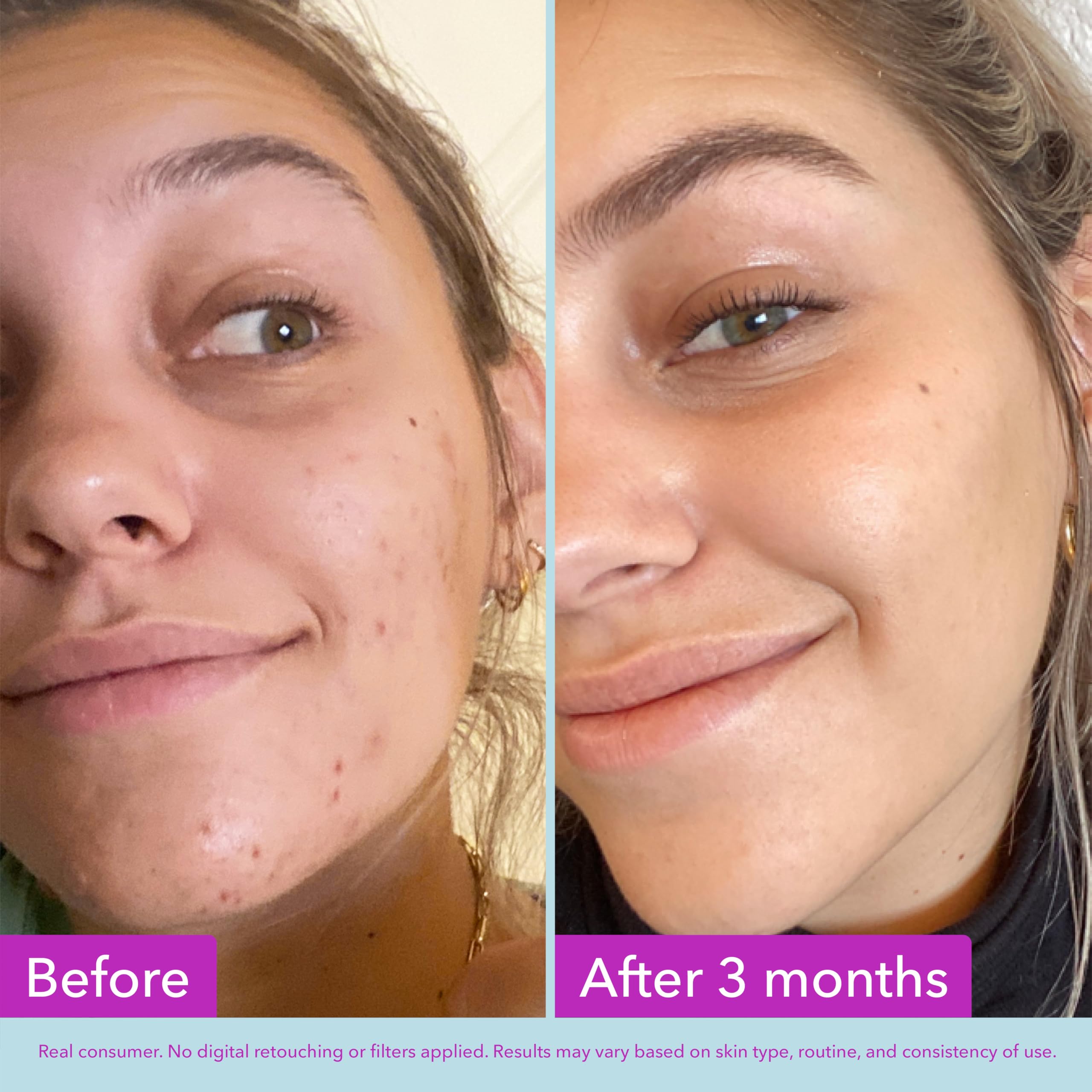 Good Molecules Niacinamide Brightening Toner – Alcohol-Free Toner with Niacinamide, Arbutin & Licorice Root Extract detail image 6