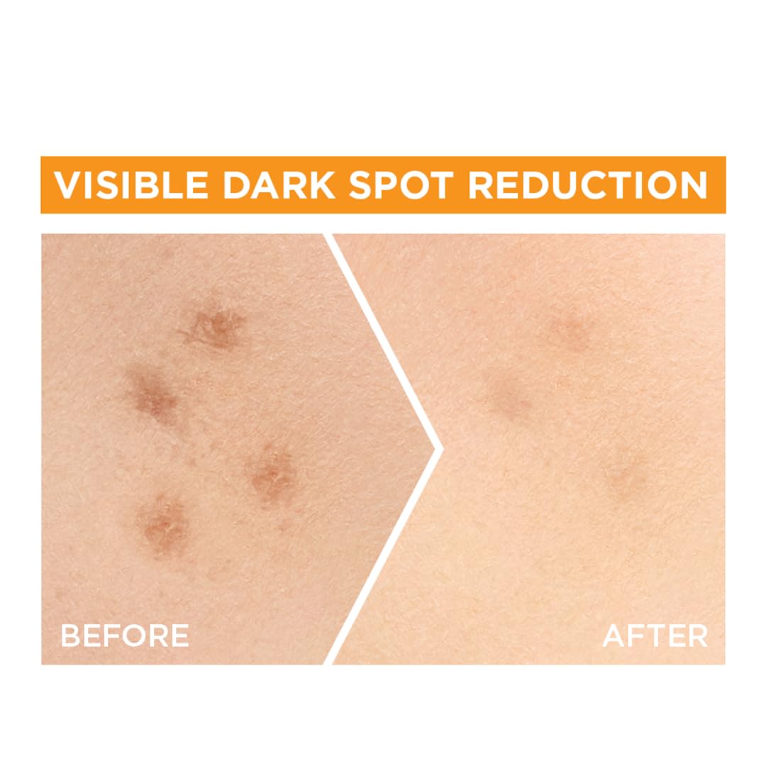 Garnier Bright Complete Vitamin C Booster Face Serum, 30 ml detail image 5