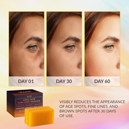 VALITIC Kojic Acid Dark Spot Removal Soap Bars with Vitamin C, Retinol, Collagen, Turmeric — Japanese Complex Infused with Hyaluronic Acid, Vitamin E, Shea Butter, Castile Olive Oil (2 Pack) detail image 9