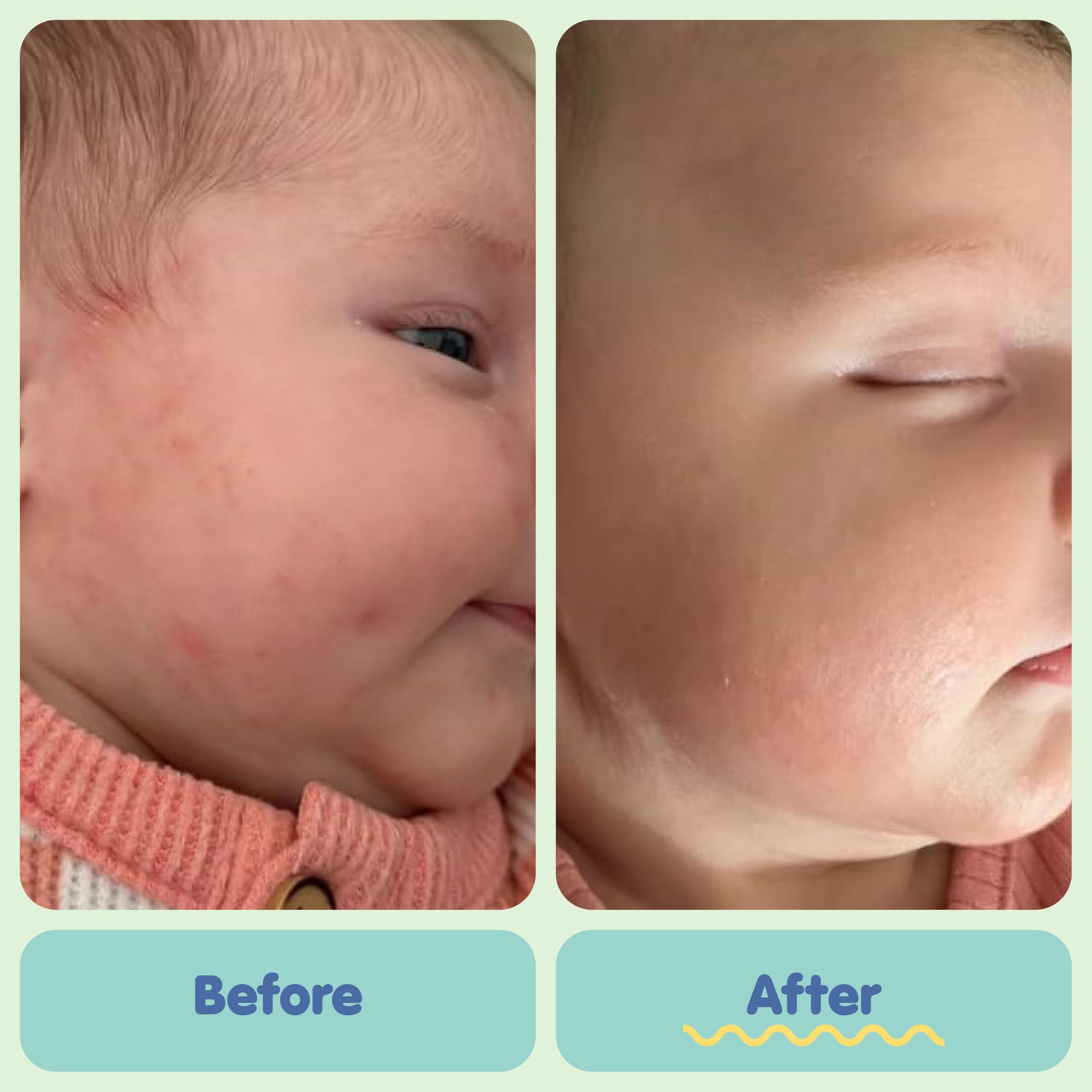 TUBBY TODD All Over Ointment Baby Eczema Cream, Everyday Multi-Purpose Baby Skin Relief Cream, Sensitive and Dry Skin, Rash & Irritation - Steroid & Gluten Free, Fragrance-Free, 8 oz, 2 Pack detail image 4