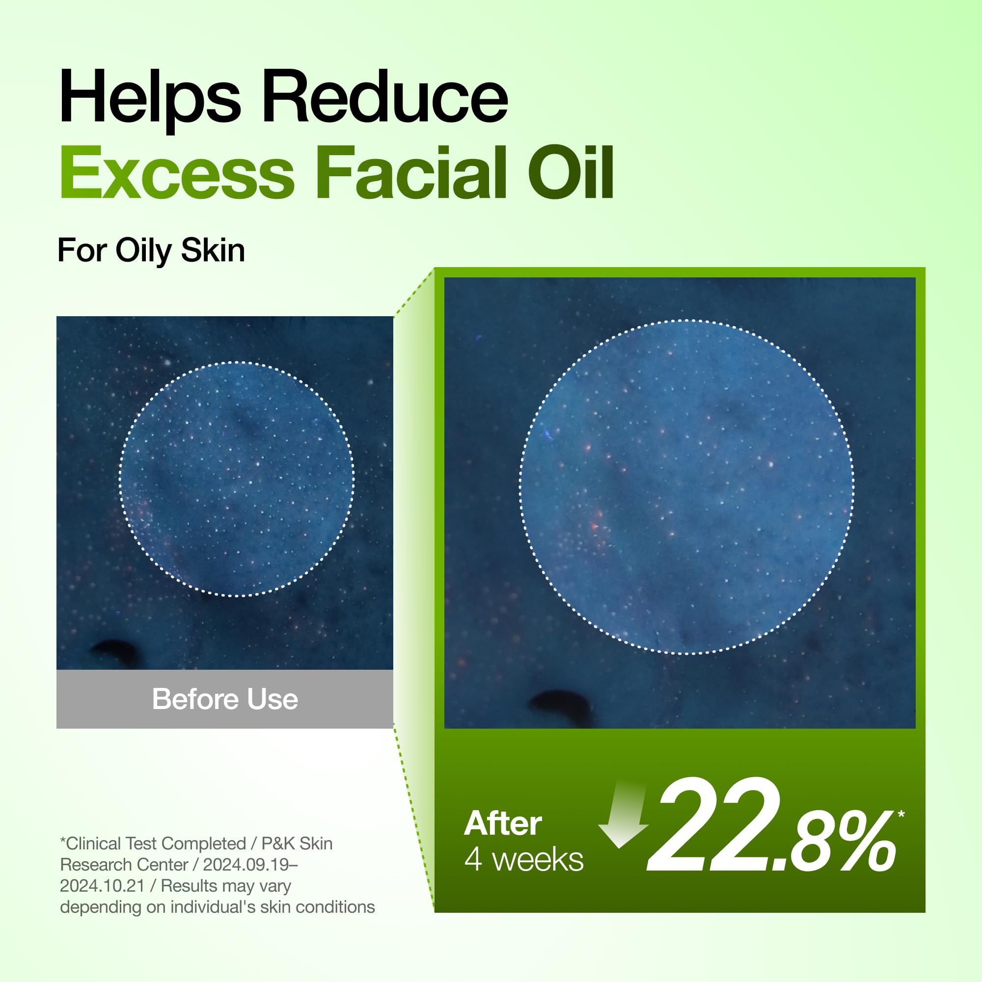 Anua Azelaic Acid 10% + Hyaluronic Acid Redness Soothing Facial Serum, 1. 01 fl oz detail image 7