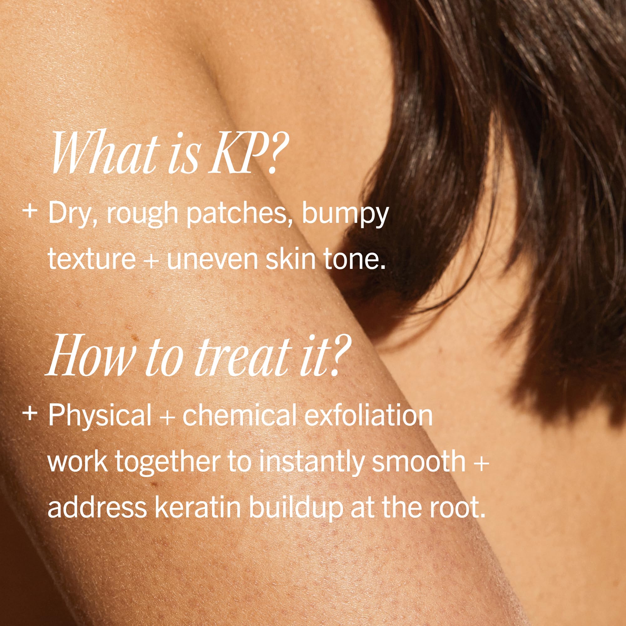 First Aid Beauty KP Bump Eraser Exfoliante Corporal con 10% AHA - Exfoliante Dermatológicamente Probado para Queratosis Pilaris - Alivio para Protuberancias, Textura Irregular y "Strawberry Skin" - Piel Sensible detail image 5