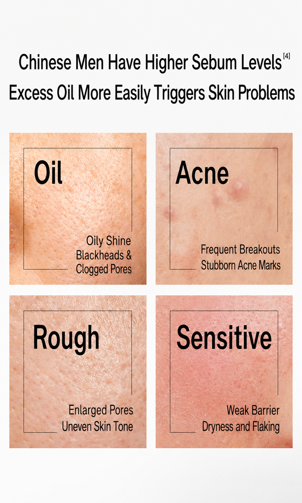 Guyu Men’s Skincare Set – Cleanser, Toner, Lotion for Oil Control & Acne (Taobao Top 1 Bestselling Men’s Skincare Set) — Specialized for Chinese Men — Holiday/Birthday Gift (Facial Cleanser 120g + Toner 120ml + Lotion 60ml + Gift Box) detail image 2